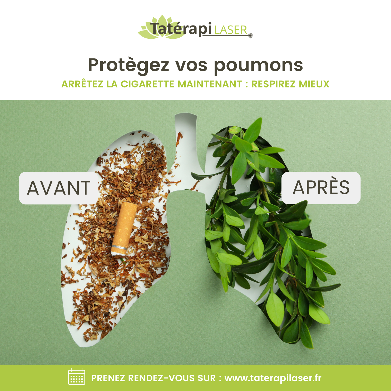 Tatérapi Laser Arras