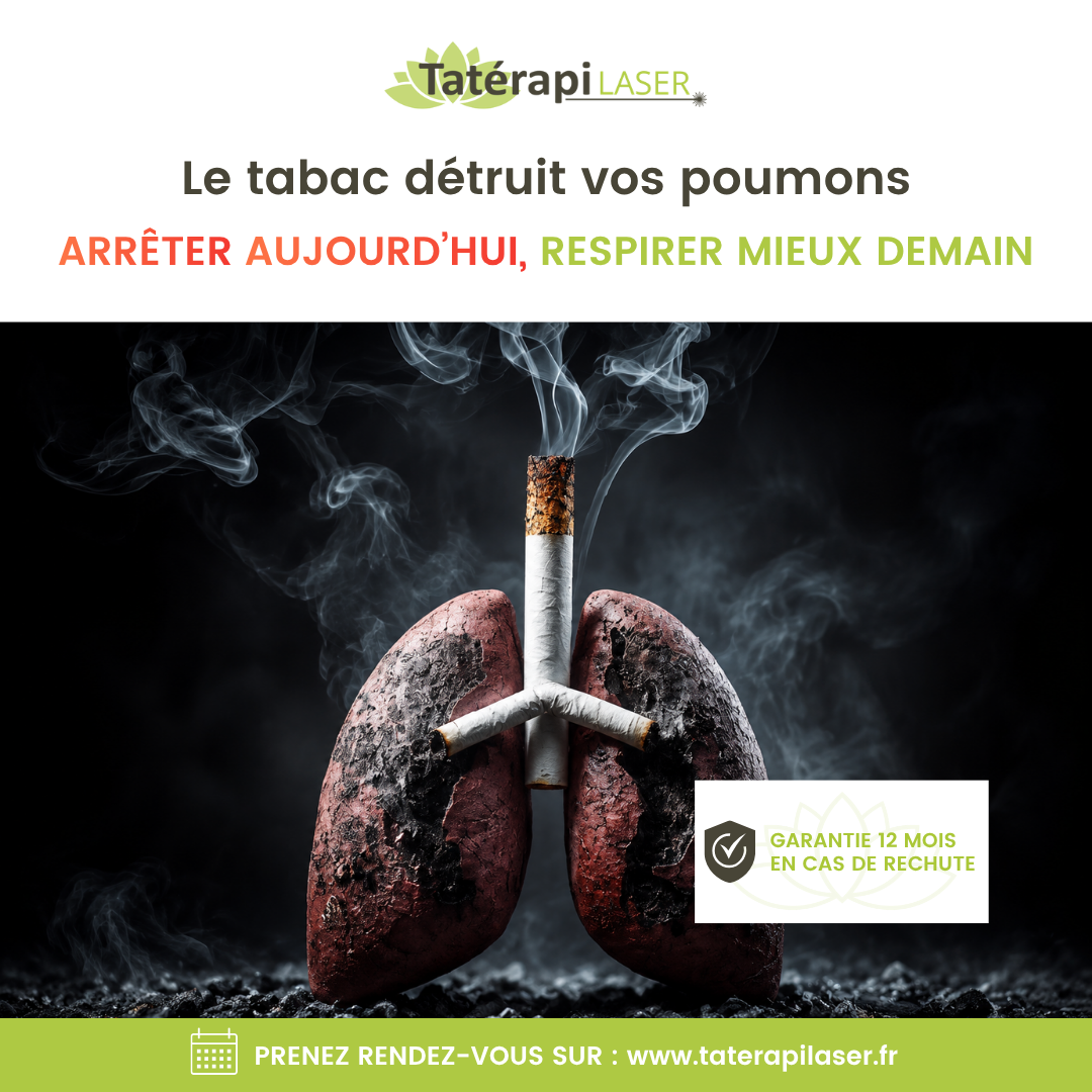 Tatérapi Laser Arras