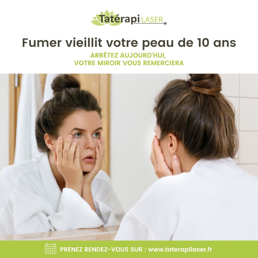 Tatérapi Laser Arras