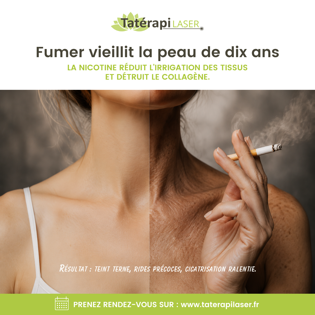 Tatérapi Laser Arras
